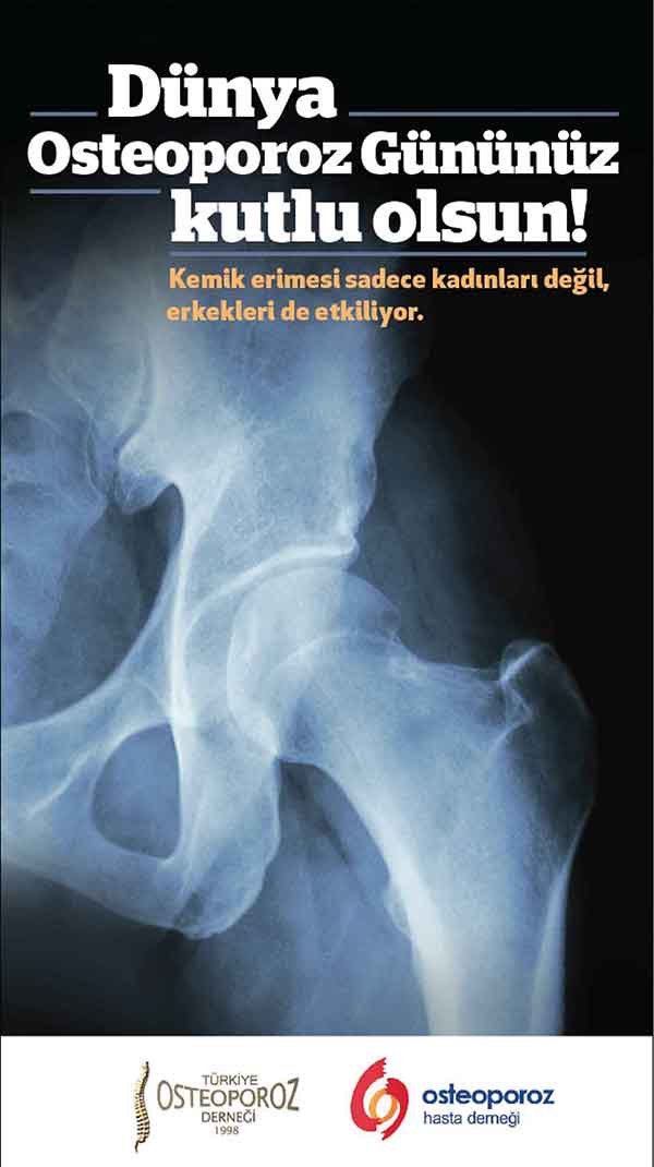 Sabah Gazetesi Osteoporoz Ticari İlan Örneği